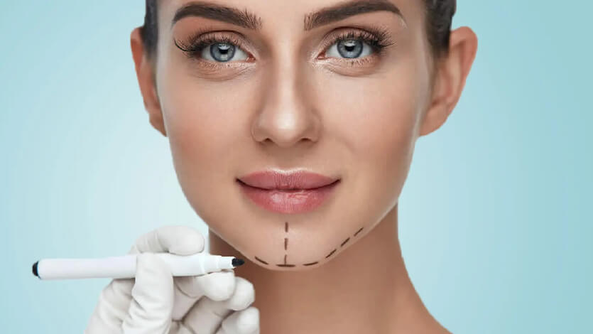 Non-Surgical Chin Reduction