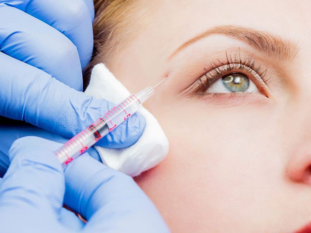 non-surgical brow lift